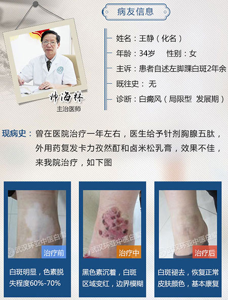 武汉病例四肢1.jpg